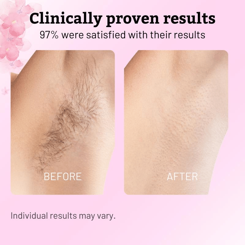 ✨  Cyperus Rotundus Oil for Natural Permanent Hair Reduction